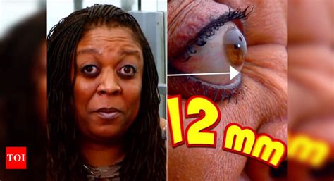 Viral Video Believe It Or Not This Eyeball Pop Is A Guinness World Record Times Of India