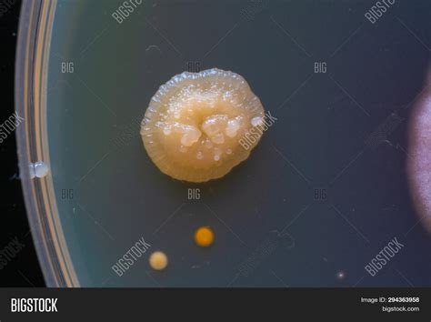 Colonies Fungi Image And Photo Free Trial Bigstock