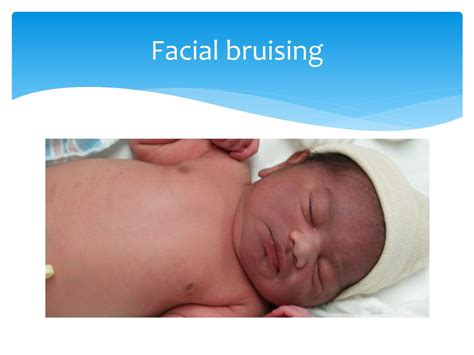 Ppt Normal Newborn Care Powerpoint Presentation Free Download Id