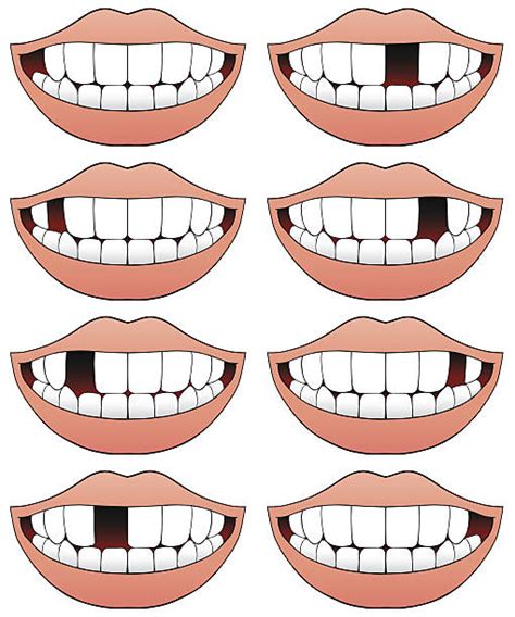 Royalty Free Gap Toothed Clip Art Vector Images And Illustrations Istock