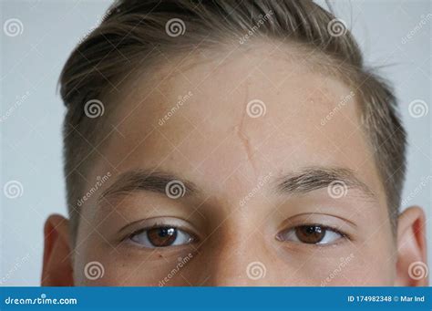 Forehead Stock Photo Image Of Brow Natural Forehead 174982348