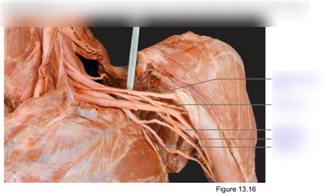 Cadaver Brachial Plexus Diagram Quizlet