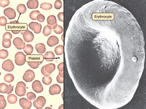 Red And White Blood Cells Under Microscope Labeled Micropedia