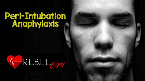 Peri Intubation Anaphylaxis Rebel Em Emergency Medicine Blog
