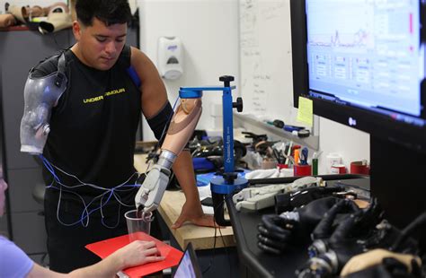 Prosthetic Arms A Complex Test For Amputees The New York Times