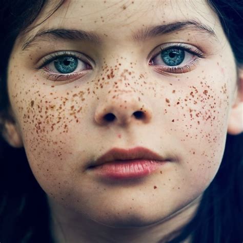 Fascinating Photos Of People With Freckles Pictolic