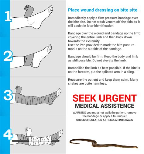 Snake Bite Treatment In 4 Quick Steps The First Aid Kits Australia