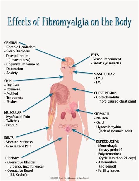 Effects Of Fibromyalgia On Your Body Chronic Fatigue Costochondritis