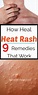 How to Get Rid of Heat Rash Quickly – 9 Remedies That Work