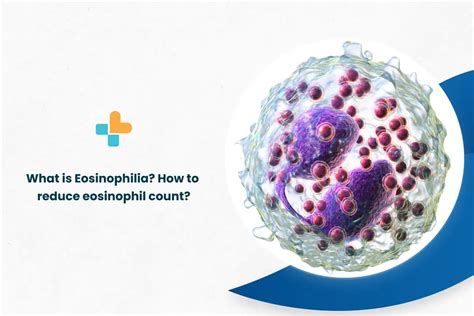 What Is Eosinophilia How To Reduce Eosinophil Count