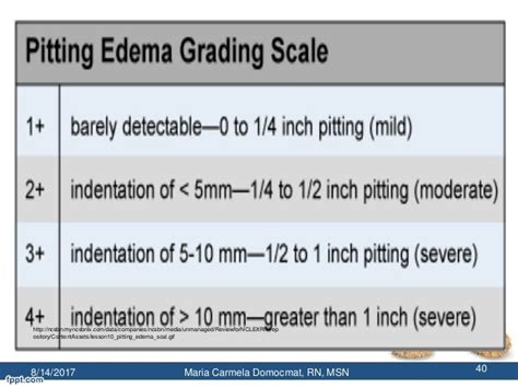 Edema Rating Scale