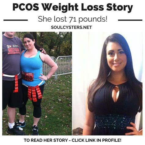 From Pcos Struggle To Pcos Success My 71 Pound Weight Loss Journey Pcos Women Pcos Weight