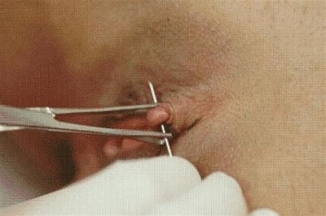 Piercing Needle Through Her Clit Now For The Ring Tumblr Porn