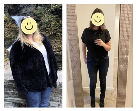59 Female 190 Lbs Fat Loss Before And After 380 Lbs To 190 Lbs
