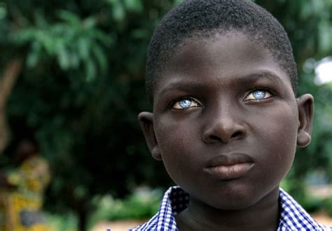 The Truth Behind Black Africans With Blue Eyes People With Blue Eyes