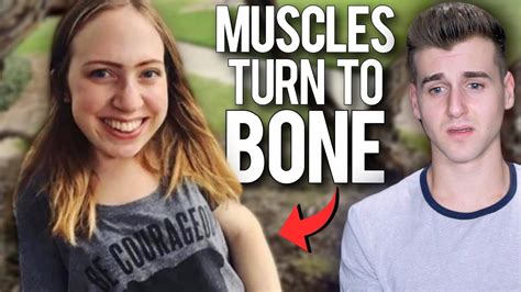 Meet The Girl Whose Muscles Are Turning Into Bone Youtube