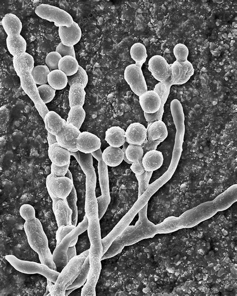 Mould Cladosporium Spp Hyphae And Spores Sem Stock Image C037