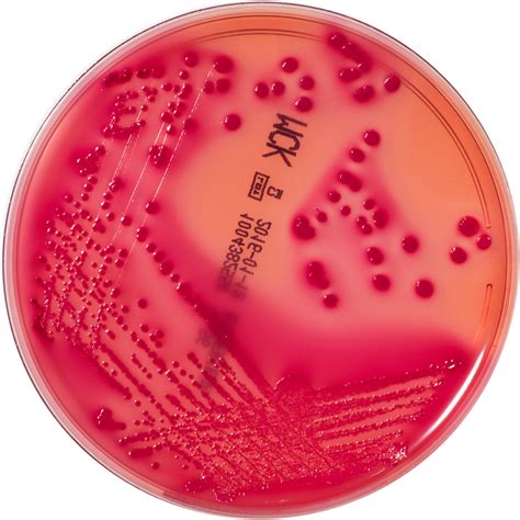 Macconkey Agar Salmonella