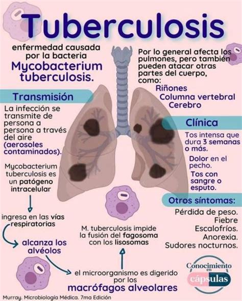 Tuberculosis Yudocorg Udocz