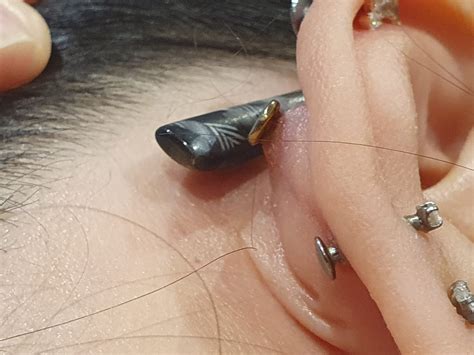 Infected Conch Piercing Rpiercing