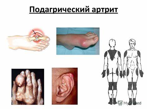 Презентация на тему: "Диф.диагностика полиартрита (ПА) Геращенко Картинка - Презентация на тему: "Диф.диагностика полиартрита (ПА) Геращенко