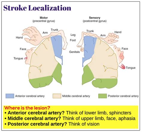 Localization Of Stroke Syndromes Medicine Keys For Mrcps