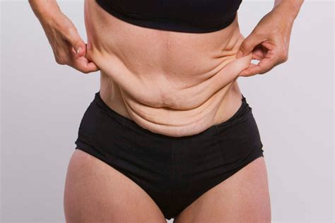 3 Ways To Tighten Loose Skin After Weight Loss 1 Up Nutrition