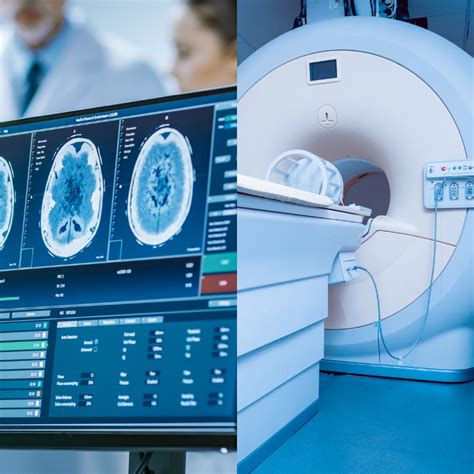 The Differences Between Ct And Mri Scans By John Ikechi Nwankwo