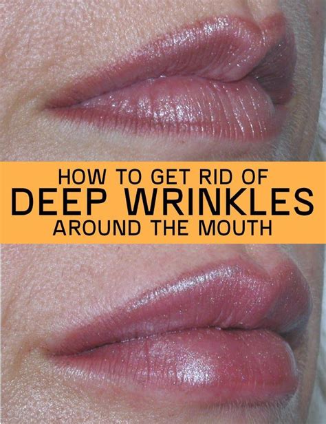 How To Get Rid Of Deep Wrinkles Around The Mouth Deep Wrinkles Mouth