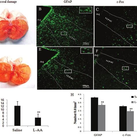 Effects Of Restraint Water Immersion Stress Rwis On Gastric Mucosal