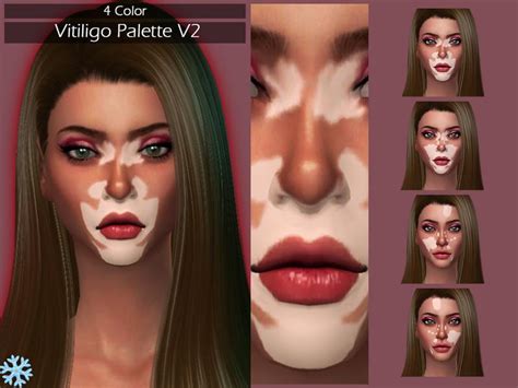 Skin Detail Vitiligo Set The Sims 4 Download Simsdomi