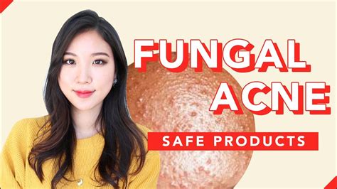 This will ensure you're always prepared for surprise skin conditions. Treatment for Acne & Fungal Infections - 10 Best One ...