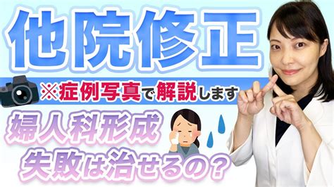 小陰唇縮小術の失敗は治る？他院修正の症例解説【婦人科形成】 Youtube