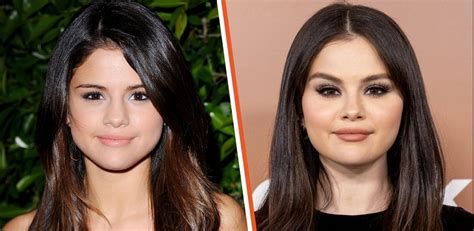 Selena Gomez Plastic Surgery Of Face Nose And Breast With Before And