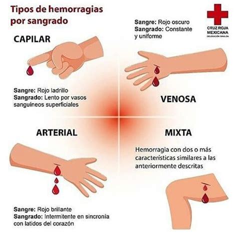 Cursos Médicos on Instagram Tipos de hemorragias por sangrados