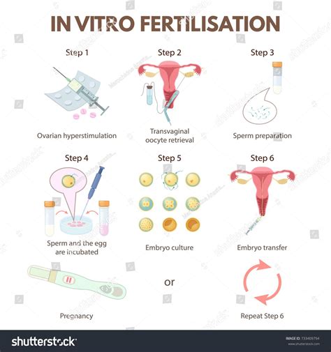 in vitro fertilization step by step method the stages of artificial insemination ivfstep method