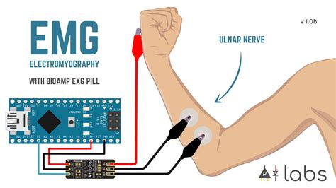 Bioamp Exg Pill Electromyography Emg Walkthrough