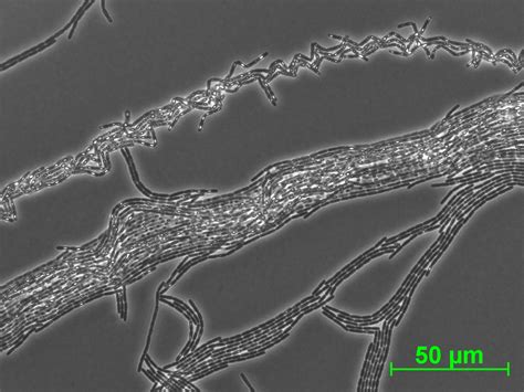 Of Bacteria And Men Filamentous Bacteria Under The Microscope