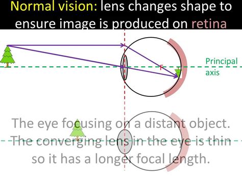 the eye and corrective lenses youtube