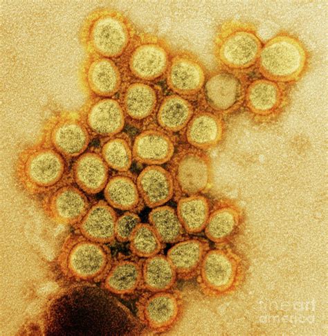 Alpha Variant Covid 19 Coronavirus Particles Photograph By National