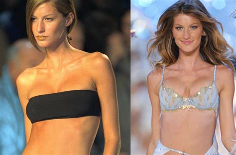 Celebrity Plastic Surgery Breast Implants Before And After