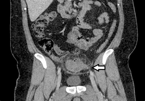 Cat Female Abdominal Ct Scan With Contrast