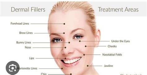 Dermal Fillers For Different Facial Areas What You Need To Know
