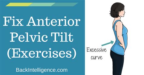 How To Fix Anterior Pelvic Tilt Posture 10 Exercises Back Intelligence