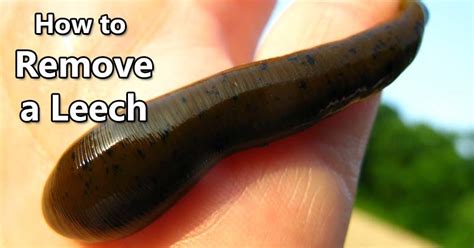 How To Safely Remove A Leech Mom Goes Camping