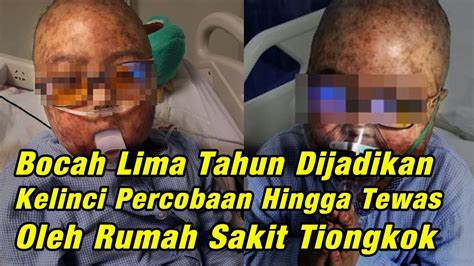 Bocah Usia 5 Tahun Diam Diam Dijadikan Kelinci Percobaan Rumah Sakit