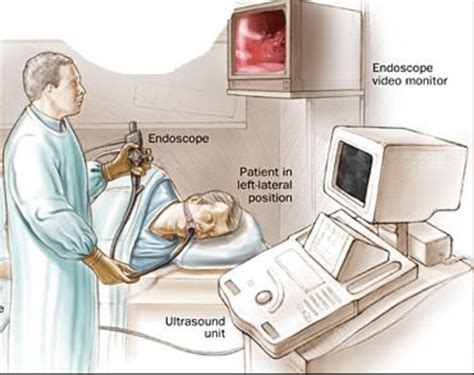 Endoscopic Retrograde Cholangiopancreatography Market Growth And