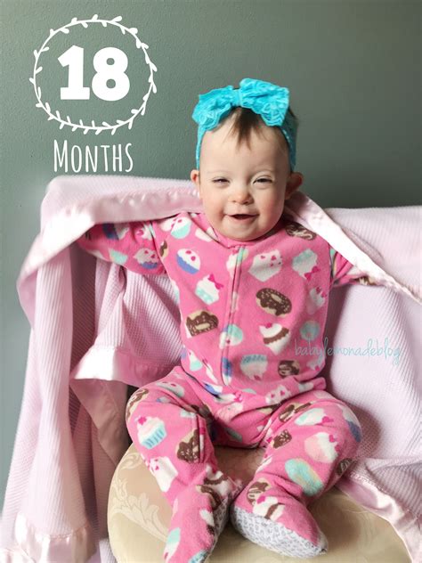 My 18-Month-Old with Down Syndrome - baby•lemonade•blog | Down syndrome baby, Down syndrome 