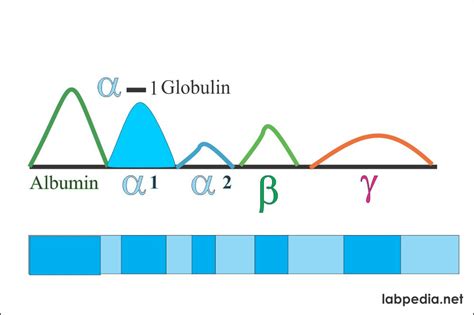 Protein Serum Electrophoresis Total Protein Albumin And Globulin