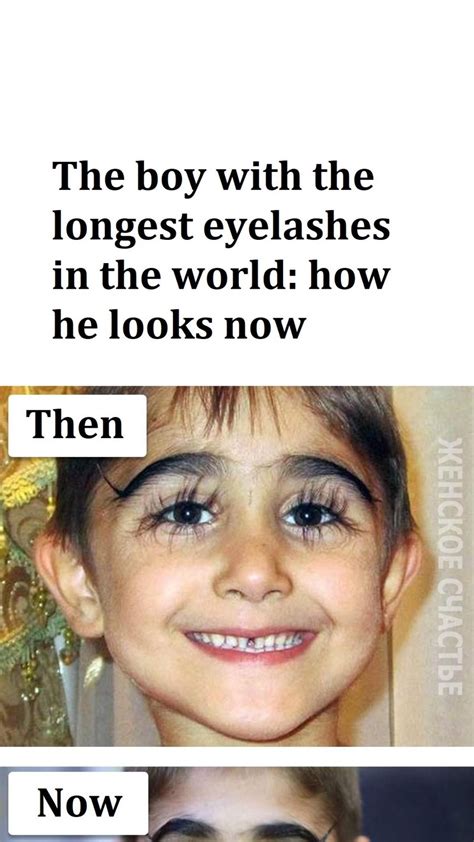 The Boy With The Longest Eyelashes In The World How He Looks Now Animals